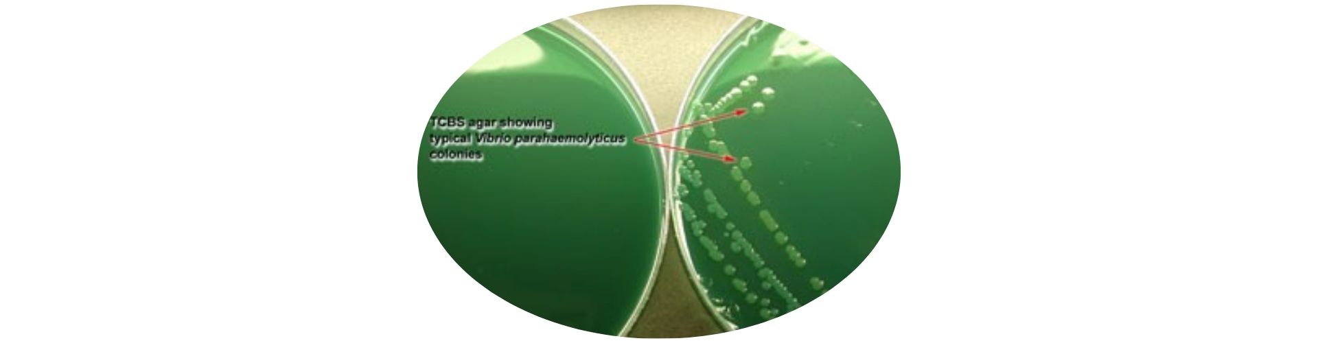 Vibrio parahaemolyticus Aranması