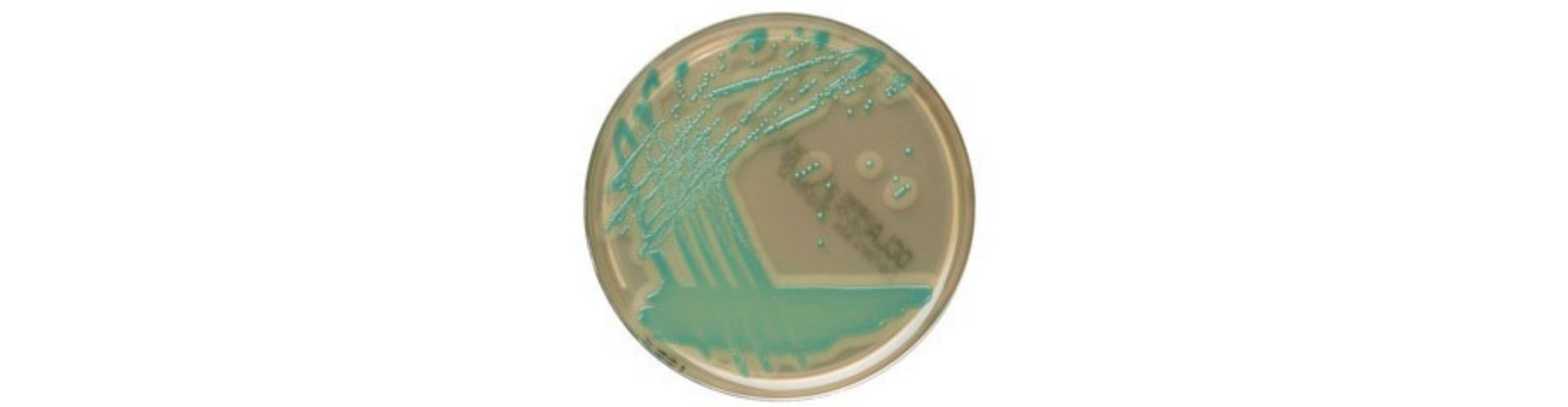 Listeria monocytogenes Aranması